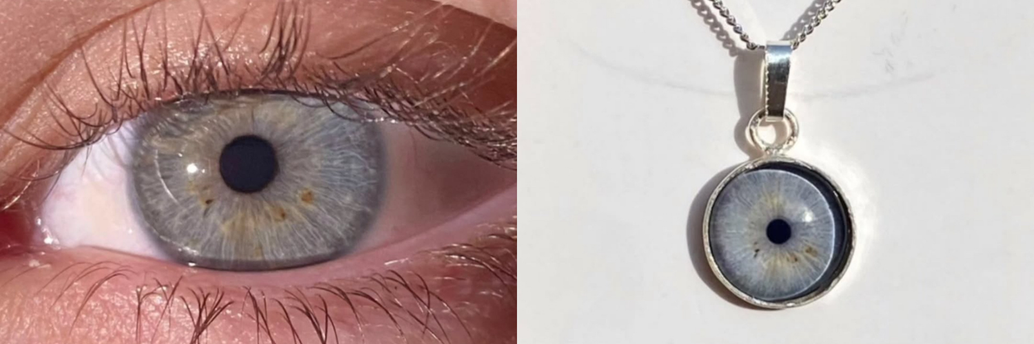 image comparison after